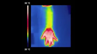 A dynamic thermoregulatory material inspired by squid skin