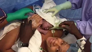 Skin-to-skin C-section birth at Michael Garron Hospital