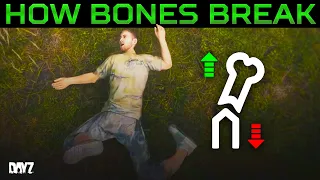 The Truth About Bone Regeneration in DayZ: How to Maximize Leg Fracture Healing Speed