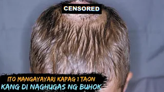 Ganito ang mangyayari sayo kapag buong buhay kang hindi naghugas ng buhok