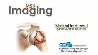Skeletal fractures imaging (I) Prof. Mamdouh Mahfouz