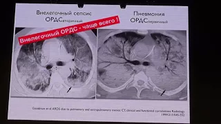 Диагностика и интенсивная терапия ОРДС рекомендации ФАР 2015 Ярошецкий А И