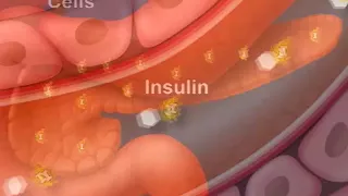How Diabetes Affects Your Blood Sugar. An Animated Guide