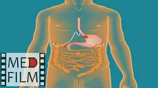 Обследование системы пищеварения у детей © Тhe digestive system in children