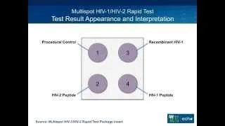 New CDC HIV Diagnostic Testing Algorithm