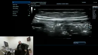 Introduction to BOWEL ultrasound