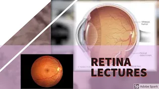 RETINA LECTURE 5 DIABETIC RETINOPATHY in detail with all important stuff