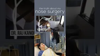 😲 The Truth About My Nose Surgery Charli D'Amelio TikTok 😲