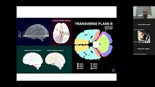 9 - Neuro Study - Stroke basics 2