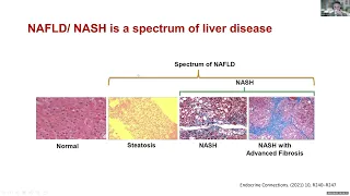 LWLD Session #3: Coping with Liver Disease (NAFLD + NASH)