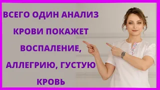 Смотри, как определить густую кровь, воспаление, наличие паразитов всего по одному анализу крови.