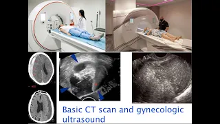 Basic CT scan and gynecologic ultrasound