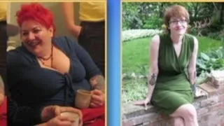 Woman Loses 200 Pounds, Now Miserable