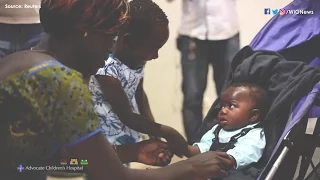 Baby girl born with four legs returns home to Ivory Coast after surgery