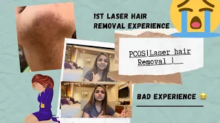 My Laser hair removal & PCOS Journey || Facial hair growth|| Gunjanvlogs