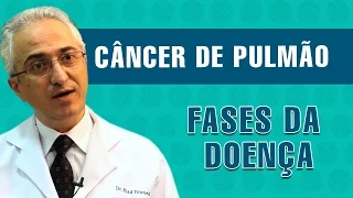 Desenvolvimento do tumor de pulmão