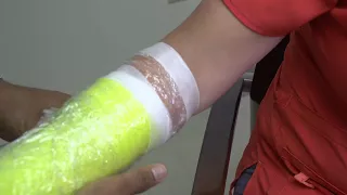 Showering or Bathing with Your Splint or Cast