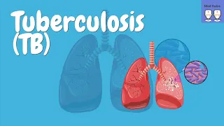 Pathophysiology of Tuberculosis [Mycobacterium tuberculosis, Epidemiology, Primary TB, Latent TB]