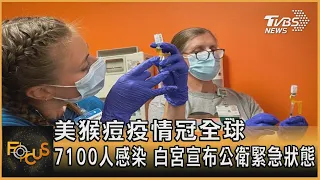 美猴痘疫情冠全球 7100人感染 白宮宣布公衛緊急狀態｜方念華｜FOCUS全球新聞 20220805