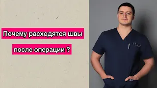 Почему расходятся швы после операции? Что будет, если разойдется шов? Пластический хирург Пластика