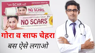 No Scars Cream Review | how to use no scars cream फायदे और नुकसान