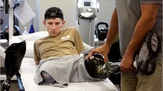 US soldier recovers after losing all four limbs