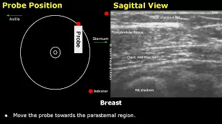 Breast Ultrasound Probe Positioning | Sagittal, Radial Views & Clock System USG Transducer Placement