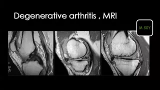 Imaging of Arthritis II Aug 2014   Dr Mamdouh Mahfouz In Arabic