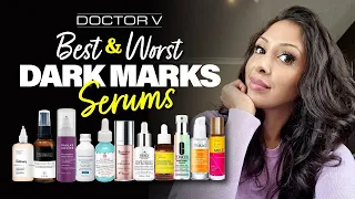 Doctor V - Best & Worst Dark Marks Serums | Skin Of Colour | Brown Or Black Skin