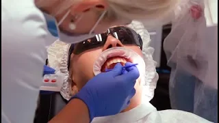 Профессиональная чистка зубов | Все этапы |AirFlow | Видео процедуры
