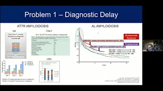 When to Suspect and How to Diagnose Amyloidosis – Julian Gillmore, MD