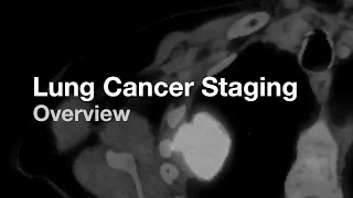 Lung Cancer Staging (Introduction)