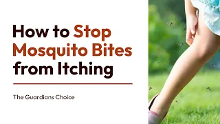 4 Ways to Stop Mosquito Bites from Itching | How to Stop Mosquito Bites from Itching
