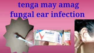 ear fungal infection