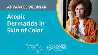 Atopic Dermatitis in Skin of Color