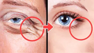 8 Min Anti-Aging Face Exercises For Eye Wrinkles, Eye Bags, Dark Circles Under Eyes | No Surgery!