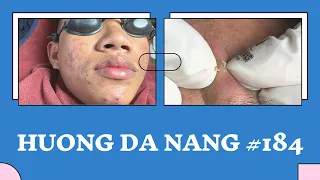 #184 | Huong Da Nang