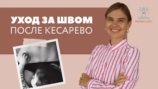 Восстановление после родов. Шов после кесарева сечения.Эфир с акушером-гинекологом Марией Трегубовой