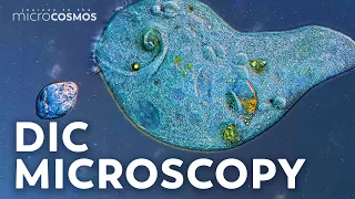 We Upgraded Our Microscope!