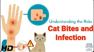 Risks Cat Bites and Infection: What Happens If You're Bitten?