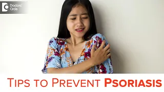 Tips to prevent Psoriasis Flare-Ups & keep it from spreading - Dr. Chaithanya K S| Doctors' Circle
