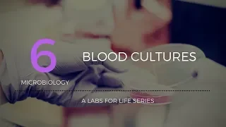 Blood cultures