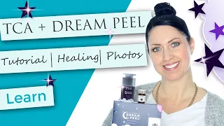 TCA + Vitamin A Dream Peel Finishing Layer Application Tutorial | Flaking Peeling Photos | How to