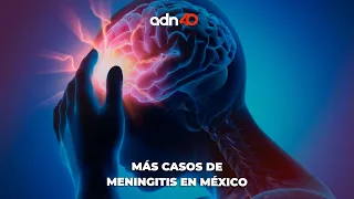 Los casos por meningitis están aumentanto considerablemente en México | Todo Personal