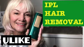 LASER HAIR REMOVAL AT HOME /ULIKE REVIEW !