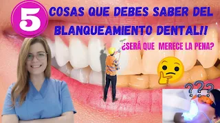 Es MALO hacerse BLANQUEAMIENTO DENTAL? 🤔 [5 cosas que DEBES saber para definir PROS y CONTRAS] 😉🦷✔️🏆