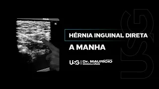 Investigando pela ultrassonografia uma hérnia inguinal direta