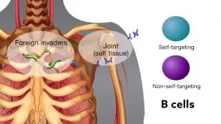 Chronic bacterial infection activates autoreactive B cells