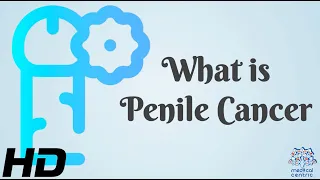 Breaking the Silence: Shedding Light on Penile Cancer