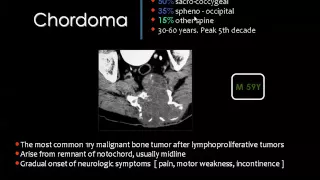 Imaging of Spinal tumors   Prof Dr  Mamdouh Mahfouz In Arabic 720p